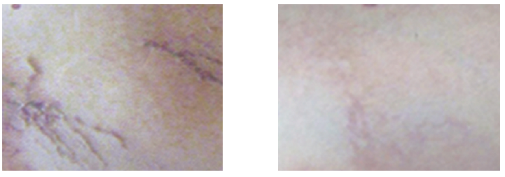 大腿.png