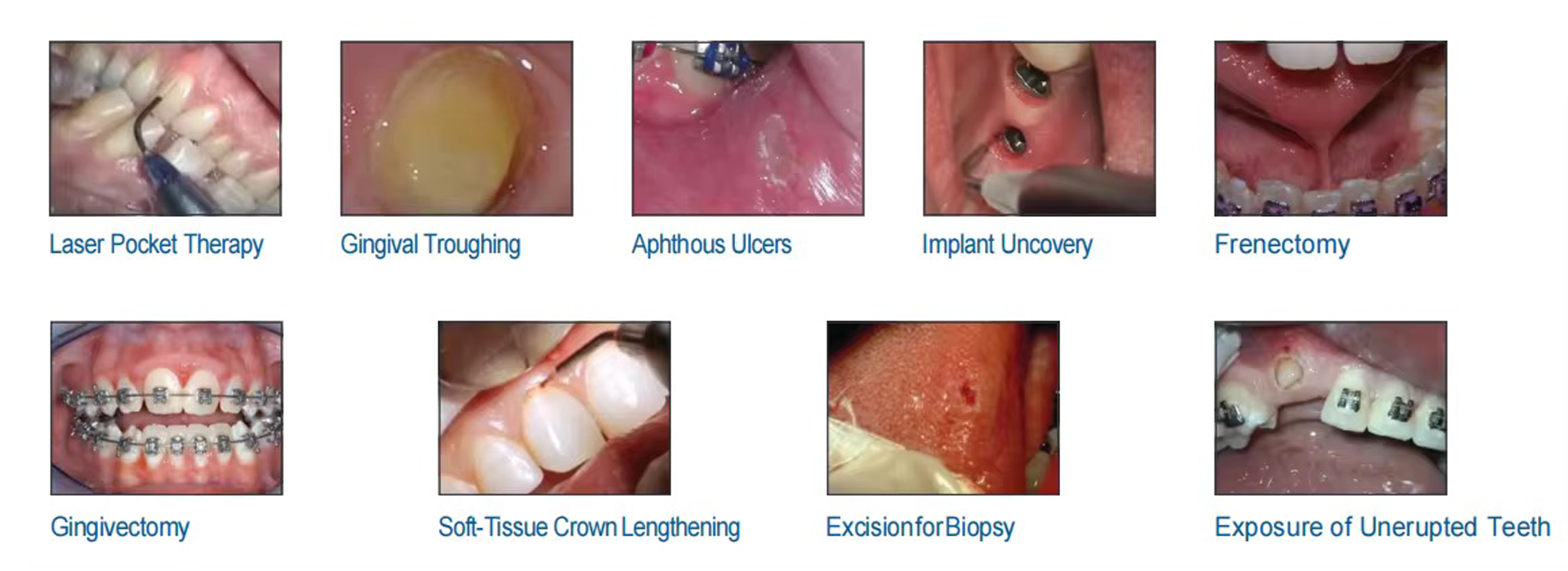 Dental 0.png